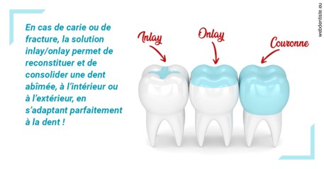 https://selarl-docteurs-korbendau.chirurgiens-dentistes.fr/L'INLAY ou l'ONLAY