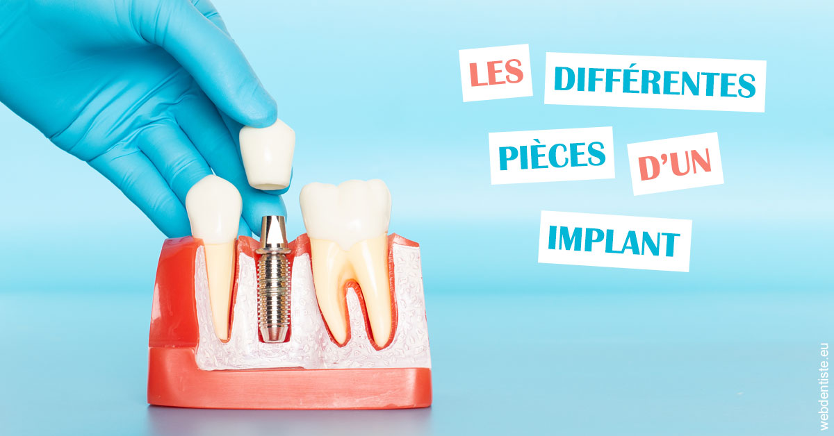 https://selarl-docteurs-korbendau.chirurgiens-dentistes.fr/Les différentes pièces d’un implant 2