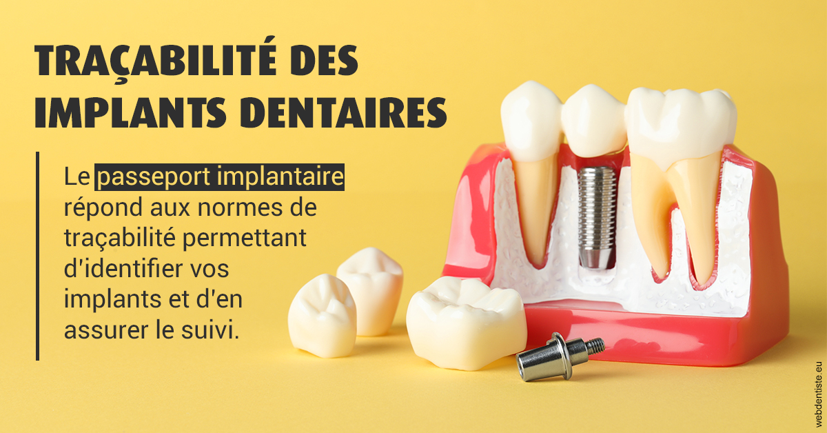 https://selarl-docteurs-korbendau.chirurgiens-dentistes.fr/T2 2023 - Traçabilité des implants 2