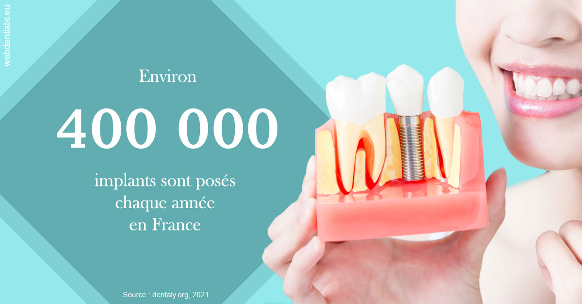https://selarl-docteurs-korbendau.chirurgiens-dentistes.fr/Pose d'implants en France 2