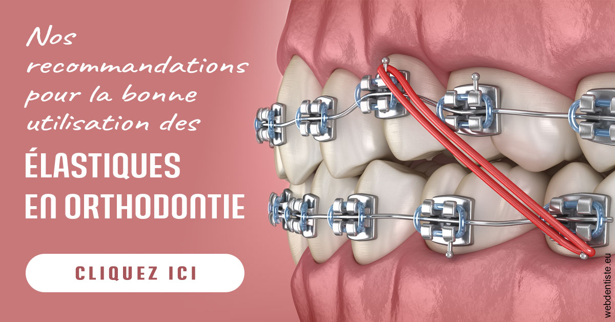 https://selarl-docteurs-korbendau.chirurgiens-dentistes.fr/Elastiques orthodontie 2